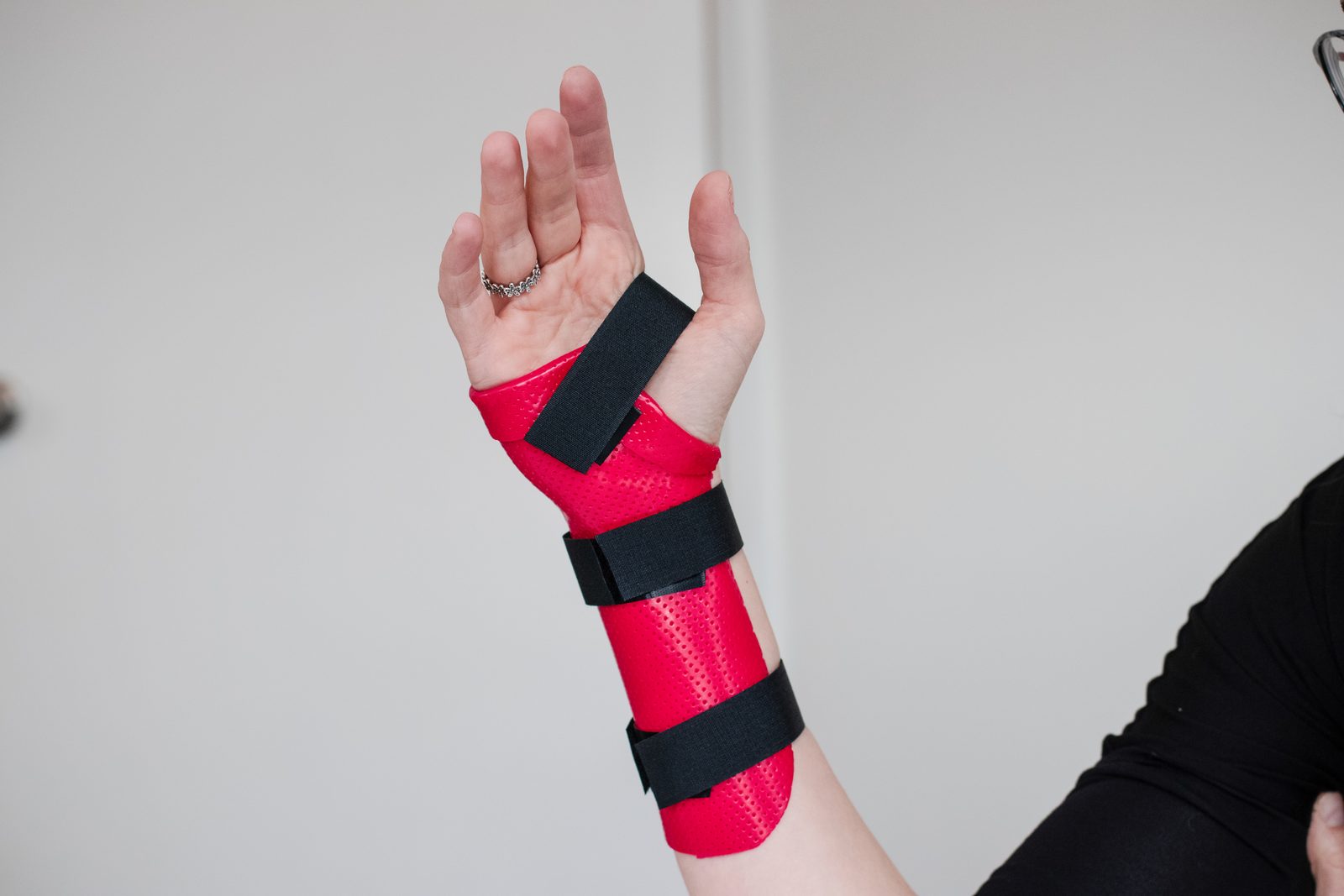 A custom-fitted red wrist splint made by Restore Hand Therapy