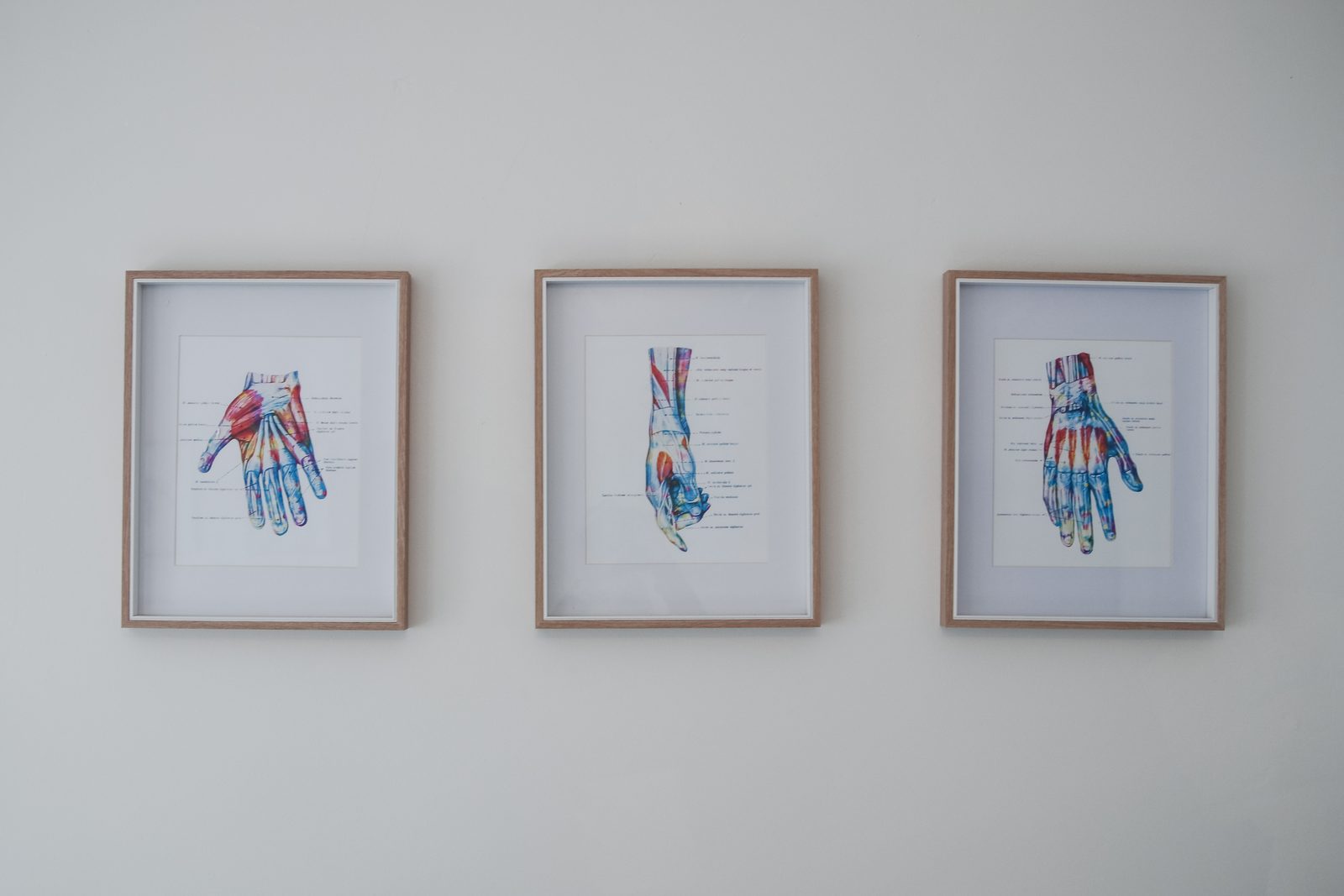 Framed hand-anatomy artwork on a clinic wall